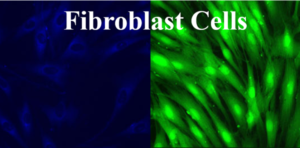 Fibroblast Cells